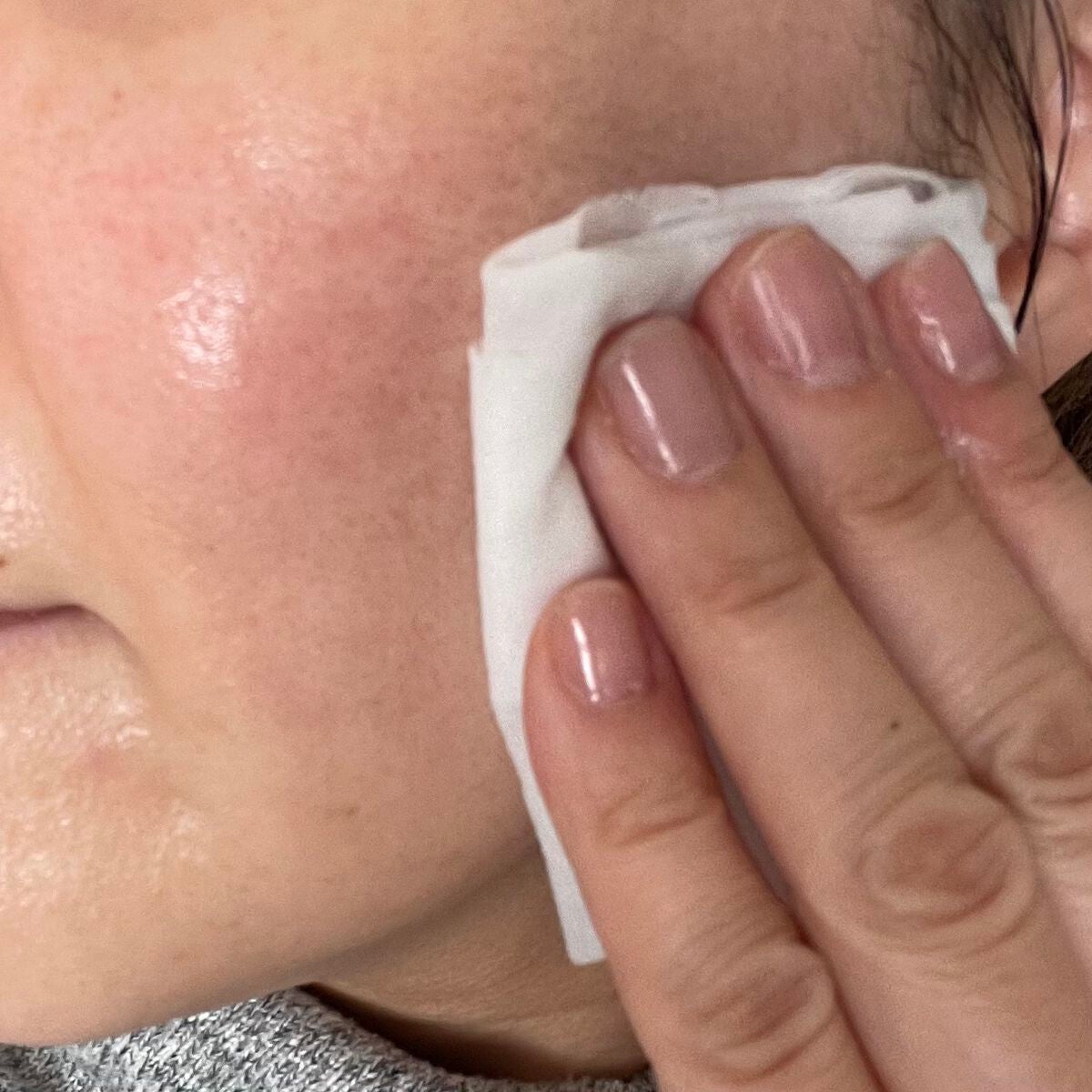 お疲れさマスク ビタットA/サボリーノ/シートマスク・パックを使ったクチコミ(10枚目)