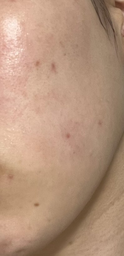 エスポア ビーグロー ボリュームクッション/espoir/クッションファンデーションを使ったクチコミ(5枚目)