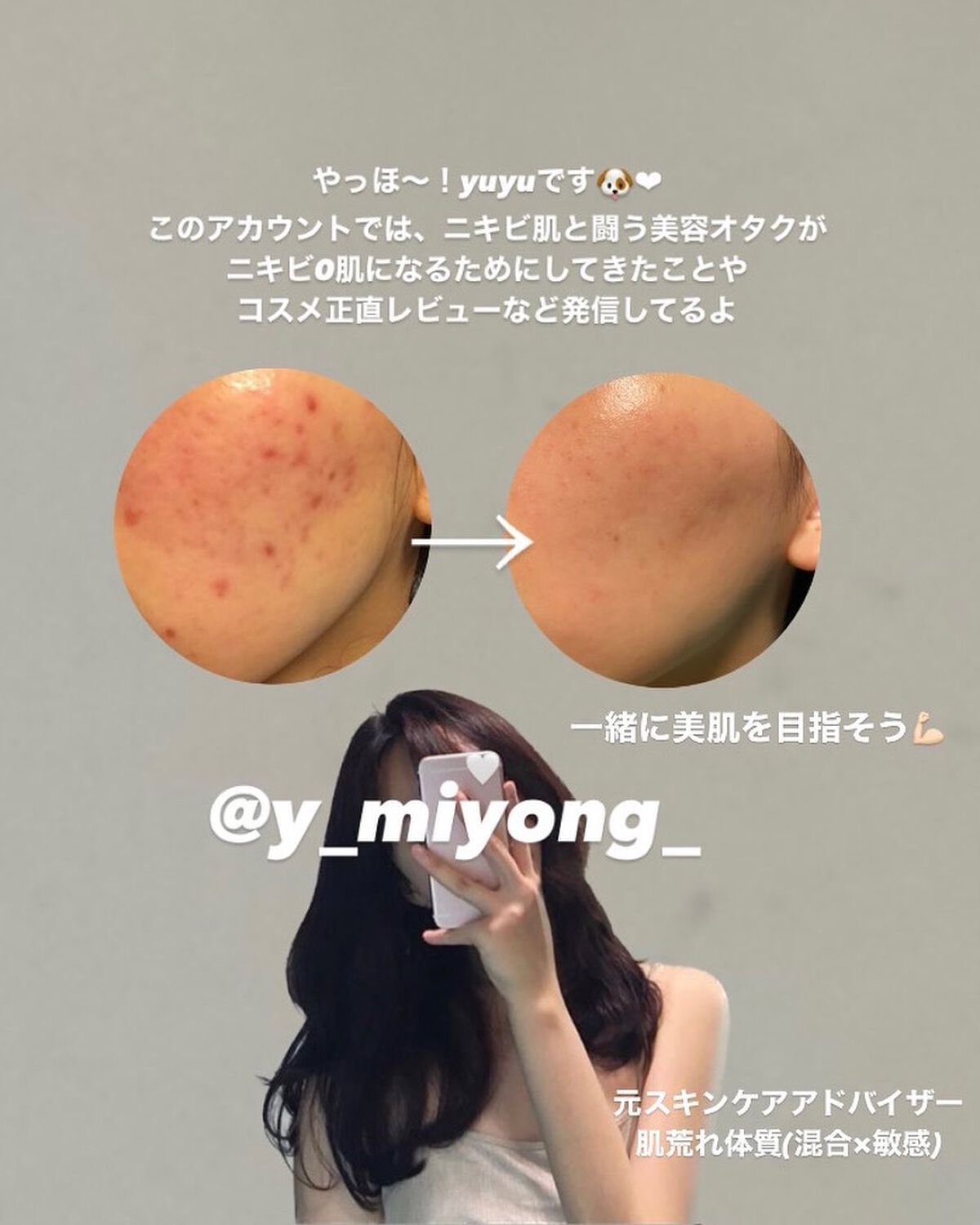 ソーダ洗顔料/manyo/洗顔フォームを使ったクチコミ（2枚目）