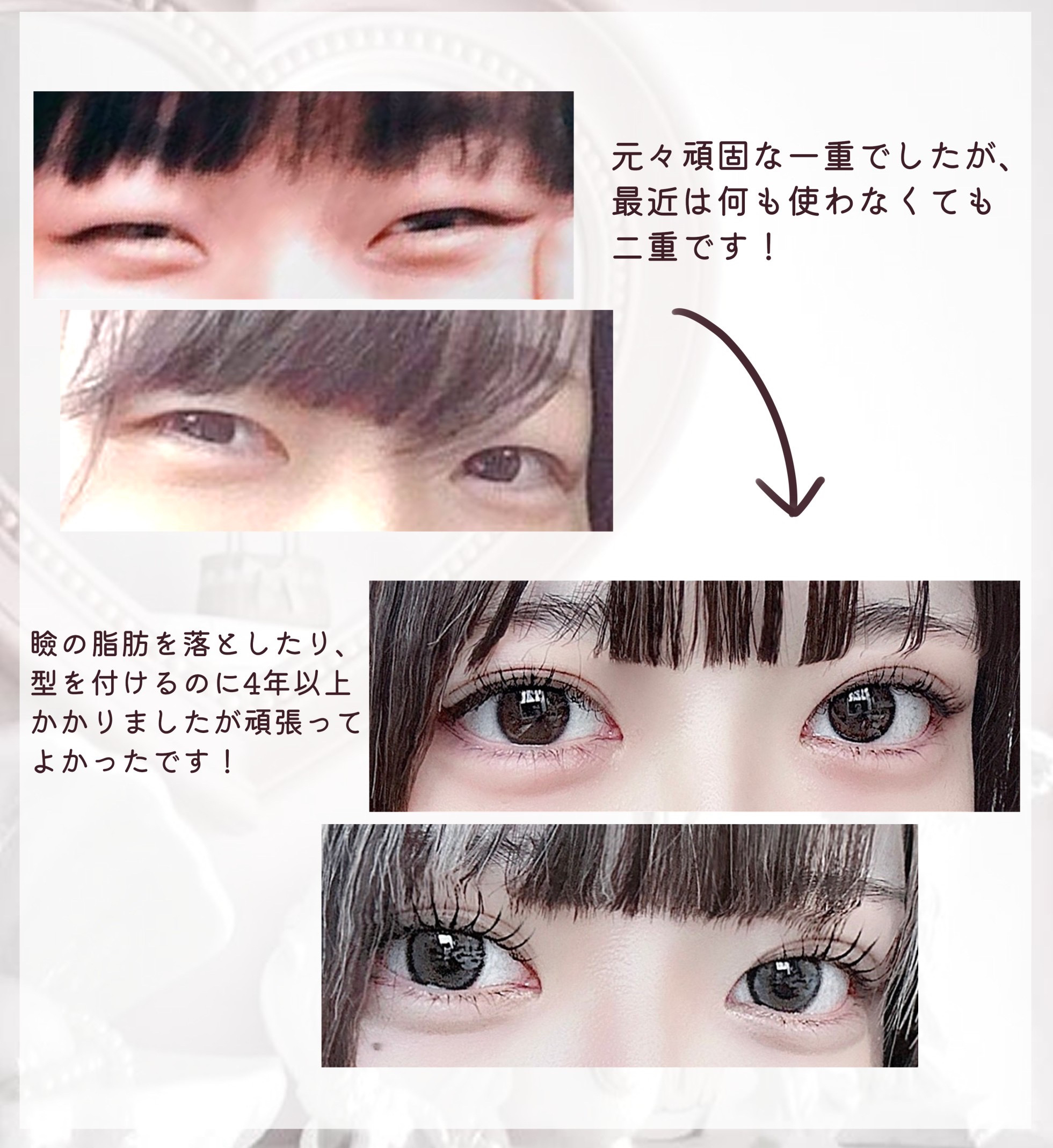 のびーるアイテープ（絆創膏タイプ、レギュラー）/DAISO/二重まぶた用アイテムを使ったクチコミ（2枚目）