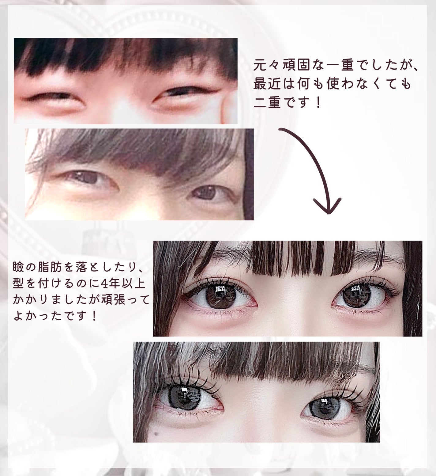 のびーるアイテープ(絆創膏タイプ、レギュラー)/DAISO/二重まぶた用アイテムを使ったクチコミ(2枚目)