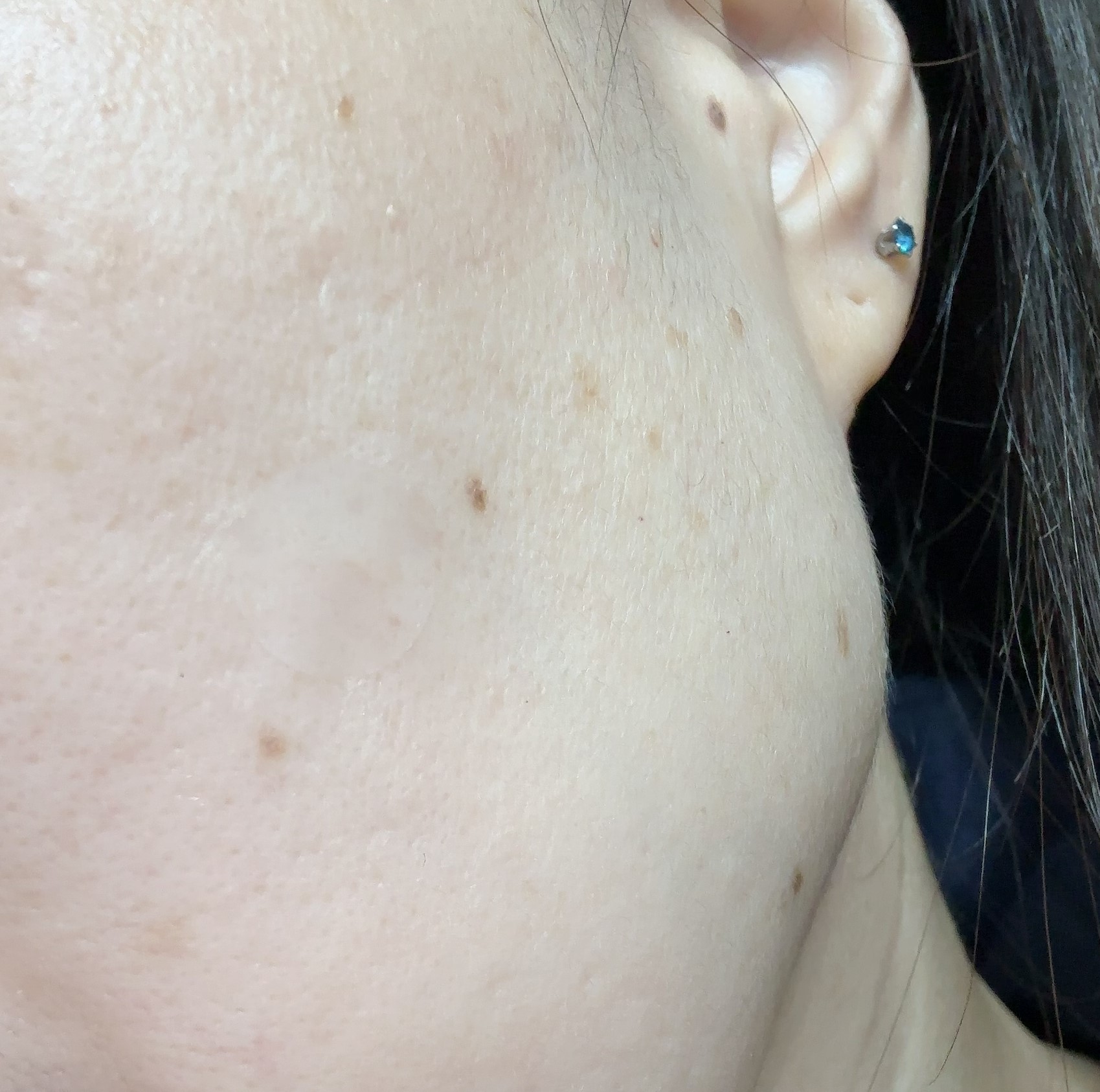 極薄透明パッチ nikipa!/金冠堂/にきびパッチを使ったクチコミ（3枚目）