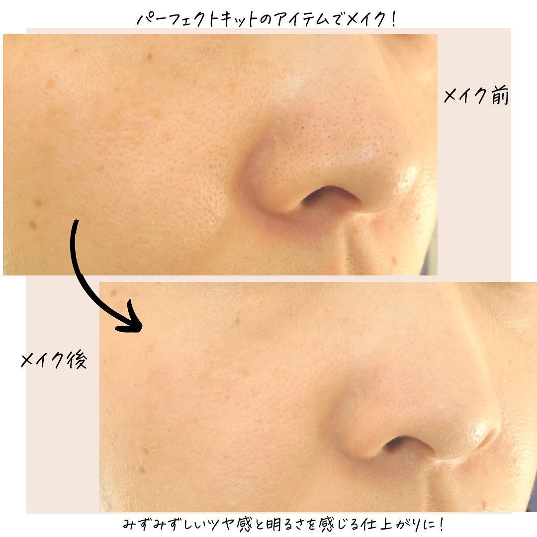 エトヴォス パーフェクトキッド/エトヴォス/トライアルキットを使ったクチコミ(5枚目)