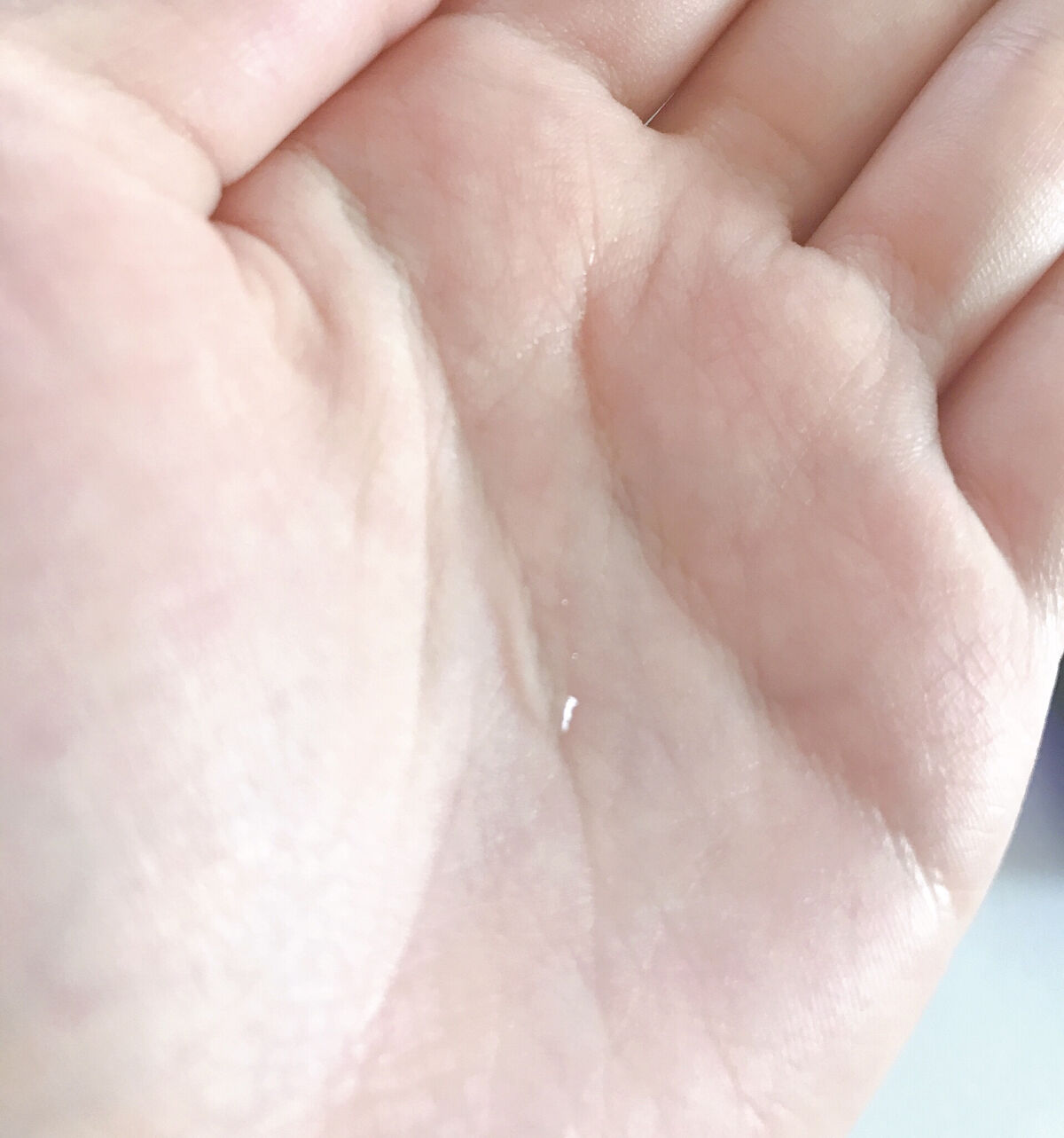 Wアプローチヘアプログラム/MUNOAGE(ミューノアージュ)/頭皮ローションを使ったクチコミ（3枚目）