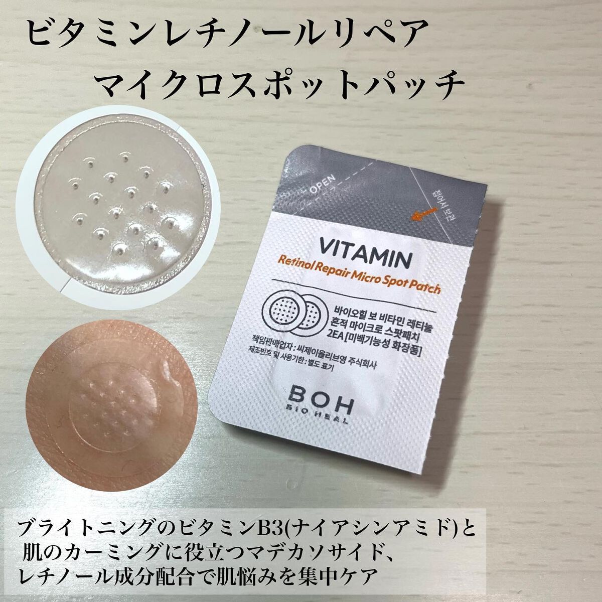 ã¡ããðž on LIPS ãBIOHEALBOH人æ°éåœã¹ãã³ã±ã¢âŒïžæ©éãªããŒã決å®âšçº..ãïŒ3æç®ïŒ