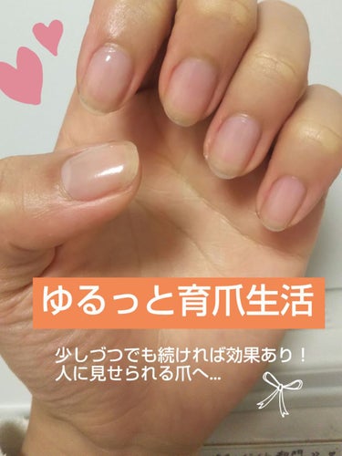 キューティクルネイルオイル ペンタイプ/No nail No life/ネイル用品を使ったクチコミ（1枚目）