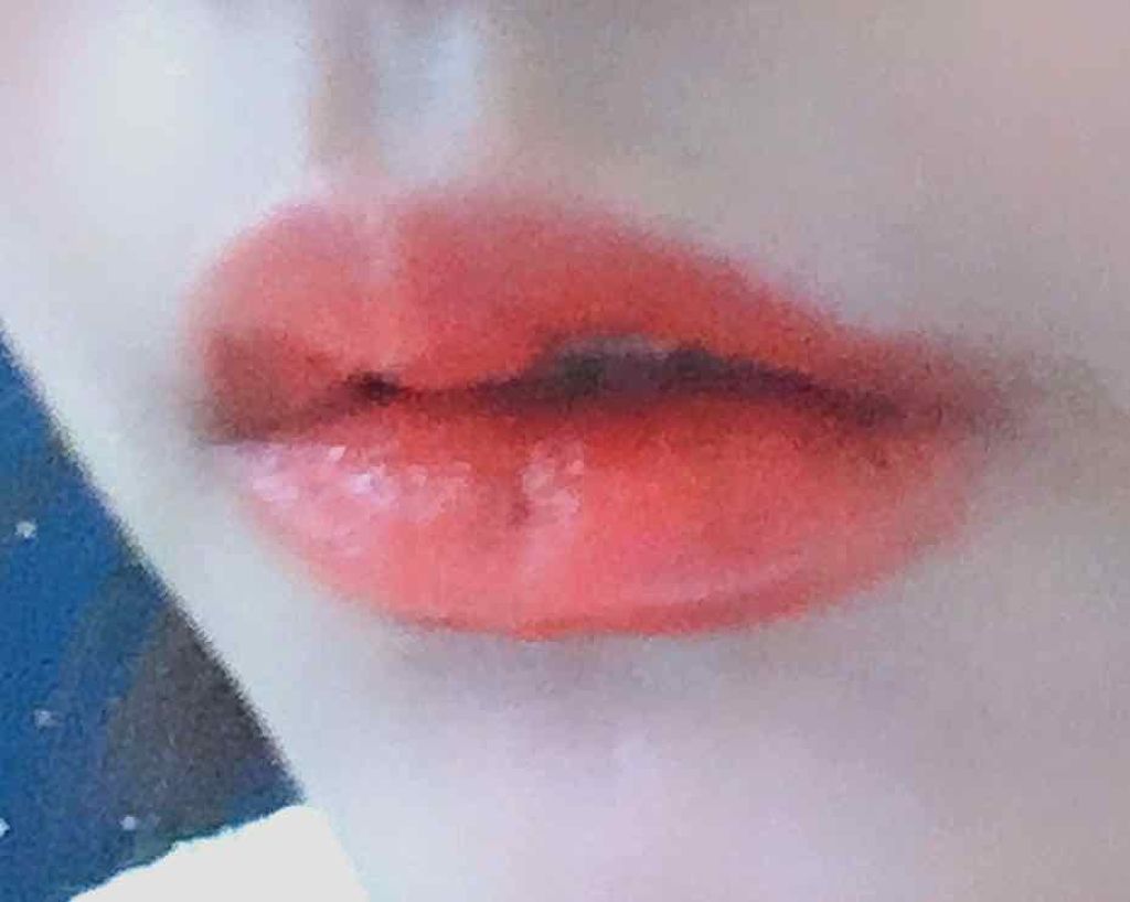 モアリップ N (医薬品)/資生堂薬品/その他を使ったクチコミ（1枚目）