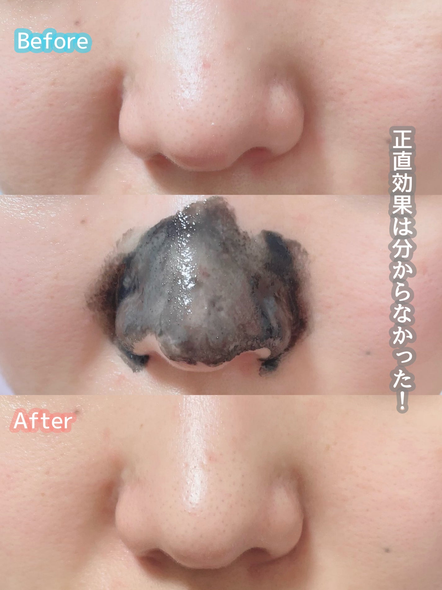 ごんす@YouTube始めました on LIPS 「《毛穴小町買ってみた❤︎》ドラッグストアなどに行った時によく見..」(5枚目)