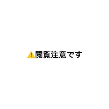 無印良品 導入化粧液のクチコミ「お久しぶりです！
6月4日現在の肌状況です (;_;)
前の投稿が5月12日だったので
約3週.....」（1枚目）