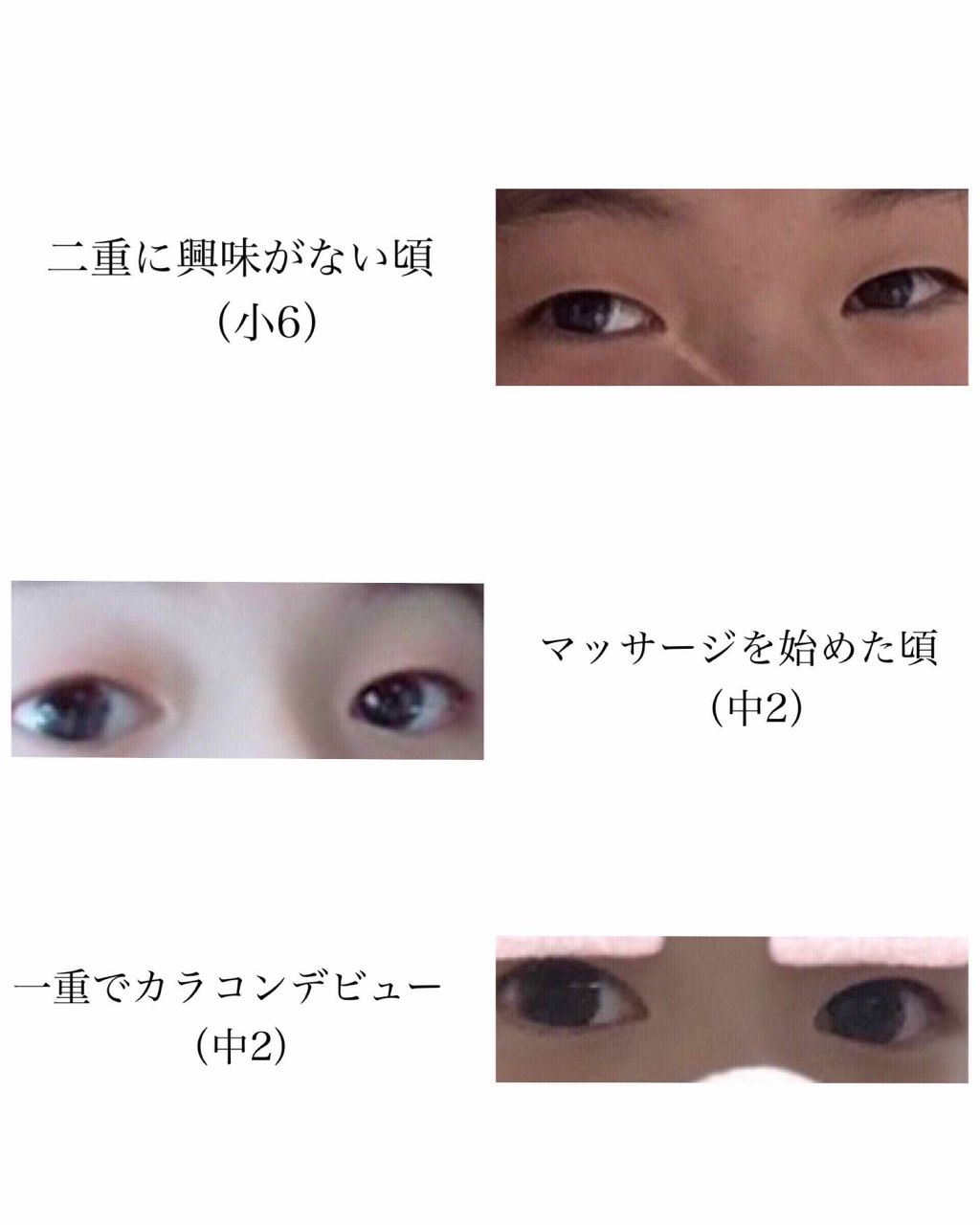 のびーるアイテープ（絆創膏タイプ、レギュラー）/DAISO/二重まぶた用アイテムを使ったクチコミ（2枚目）