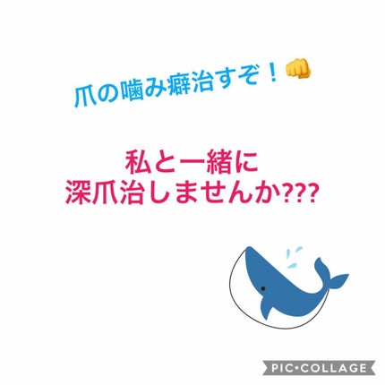 サンリオネイル/DAISO/マニキュアを使ったクチコミ(1枚目)