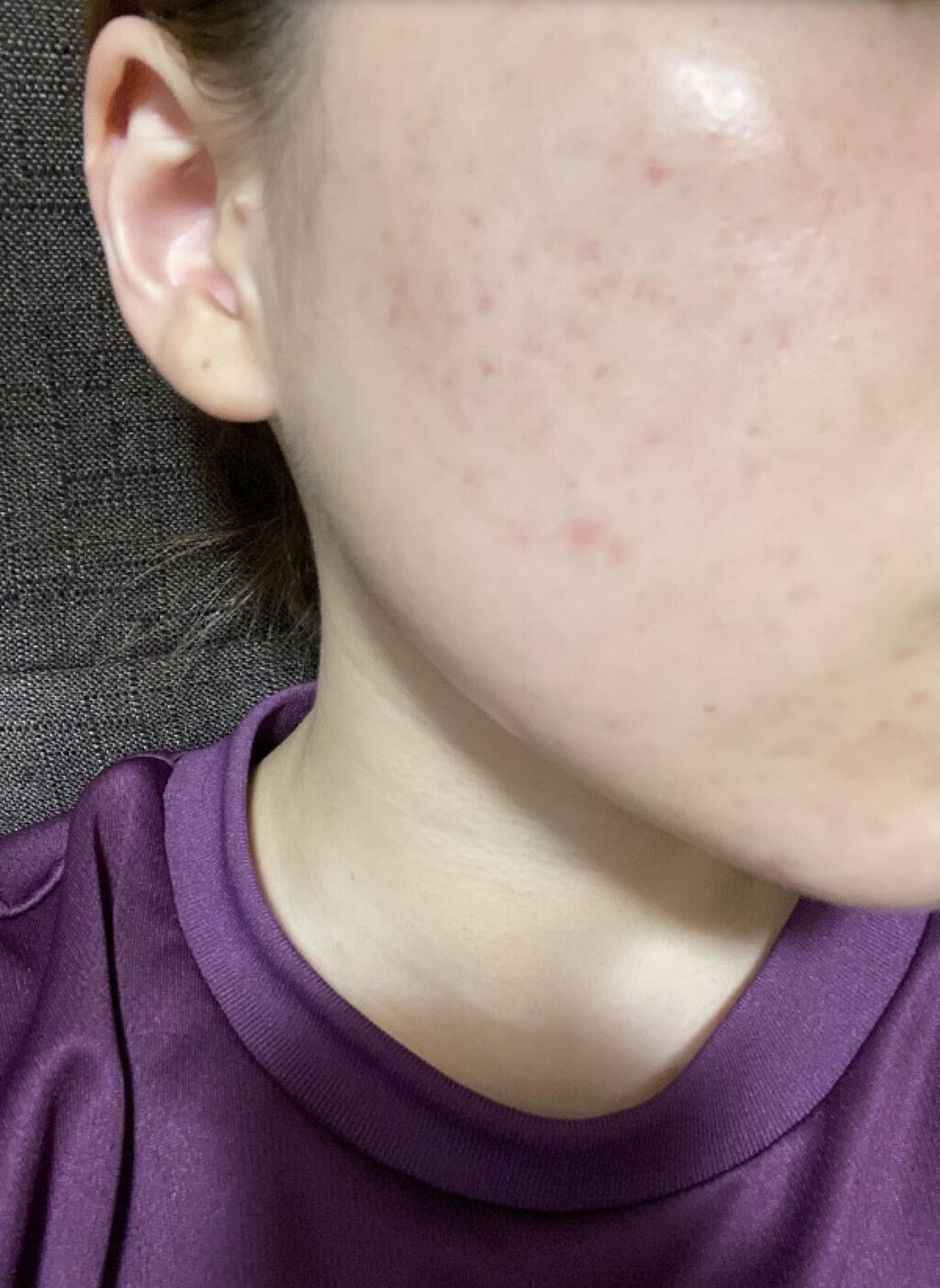 コンセントレート インジュビネーション マスク/ジュレリッチ/シートマスク・パックを使ったクチコミ（1枚目）