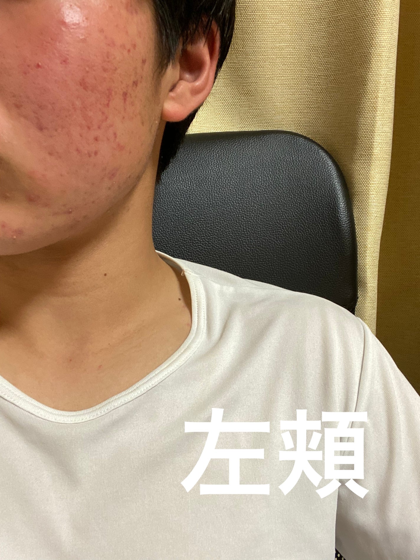 レチノショット 0.1/TOUT VERT/フェイスクリームを使ったクチコミ(2枚目)