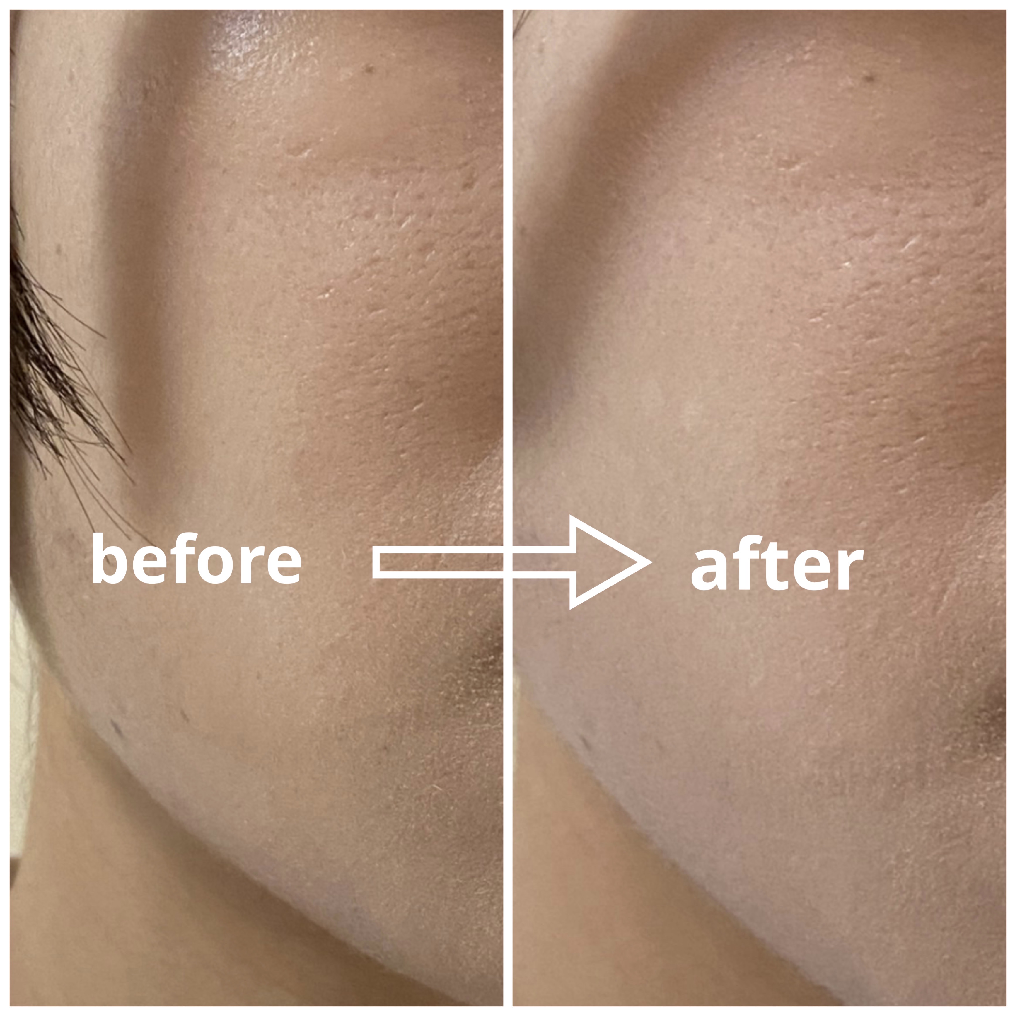 ルースパウダー/HOJO/ルースパウダーを使ったクチコミ（2枚目）