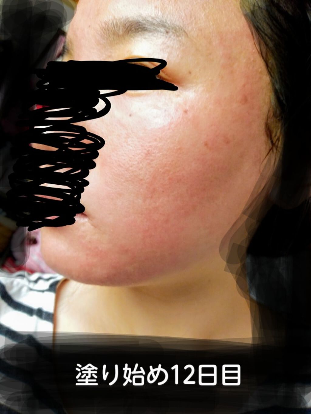 日本酒の化粧水/菊正宗/化粧水を使ったクチコミ（2枚目）