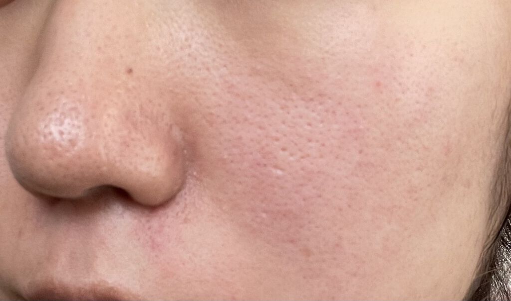 薬用しみ対策 美白化粧水/メラノCC/化粧水を使ったクチコミ（2枚目）