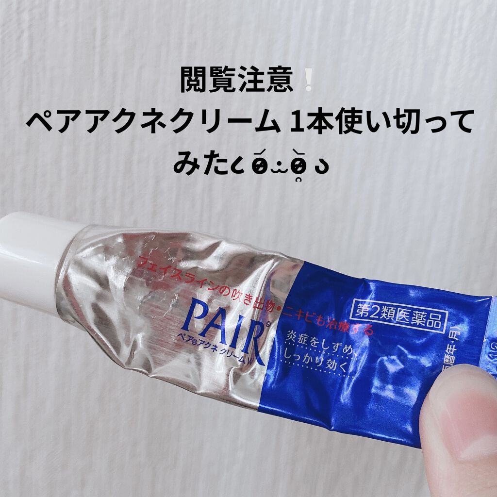 ペアアクネクリームW(医薬品)/ペア/その他を使ったクチコミ（1枚目）