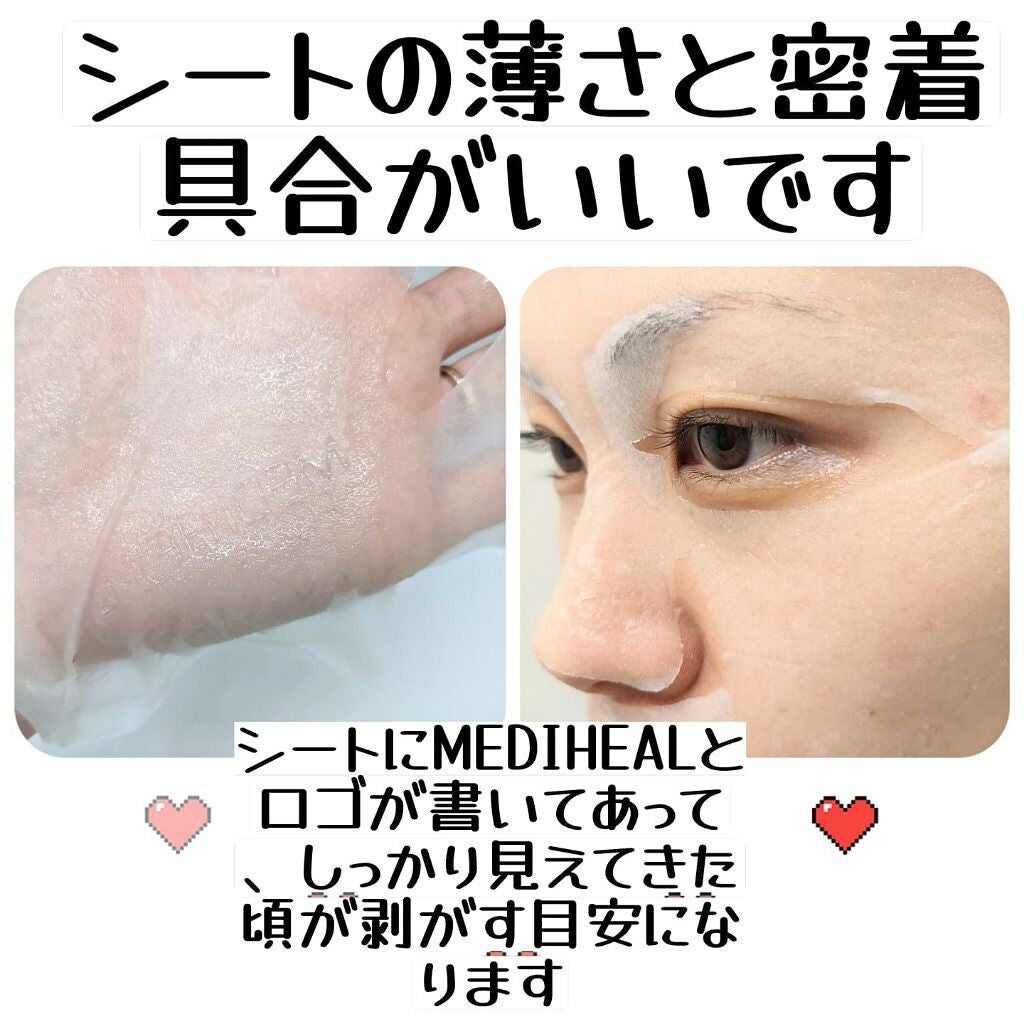 ビタライトビームエッセンシャルマスクEX/MEDIHEAL/シートマスク・パックを使ったクチコミ(2枚目)