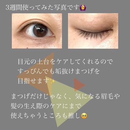 アイラッシュセラム/BASATTO/まつげ美容液を使ったクチコミ(4枚目)