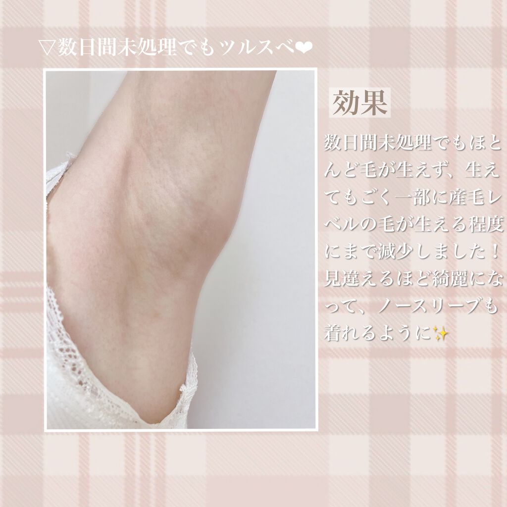 クアトロライト (2本入)/シック/シェーバーを使ったクチコミ(7枚目)