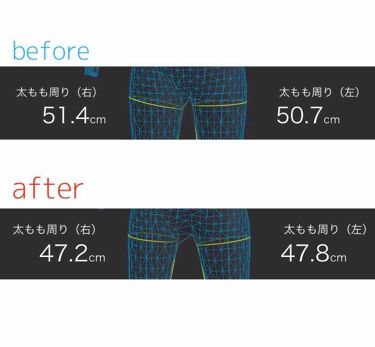 寝ながらメディキュット スパッツ 骨盤テーピング メディキュットの口コミ 2ヶ月履くだけで脚やせ成功 楽々脚やせ By 只野デブ 混合肌 Lips 寝ながらメディキュット スパッツ 骨盤テーピング メディキュットの口コミ 2ヶ月履くだけで脚やせ成功 楽々脚やせ By 只野デブ 混合肌 Lips
