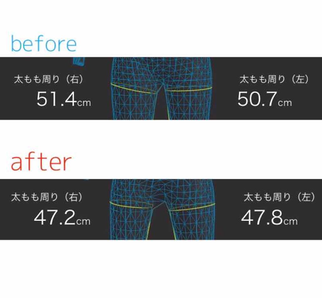 寝ながらメディキュット スパッツ 骨盤テーピング/メディキュット/着圧ソックス・レギンスを使ったクチコミ(2枚目)