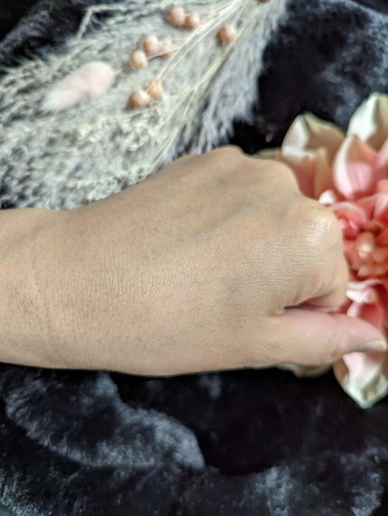 ピンクティーツリートナー/APLIN/化粧水を使ったクチコミ(5枚目)