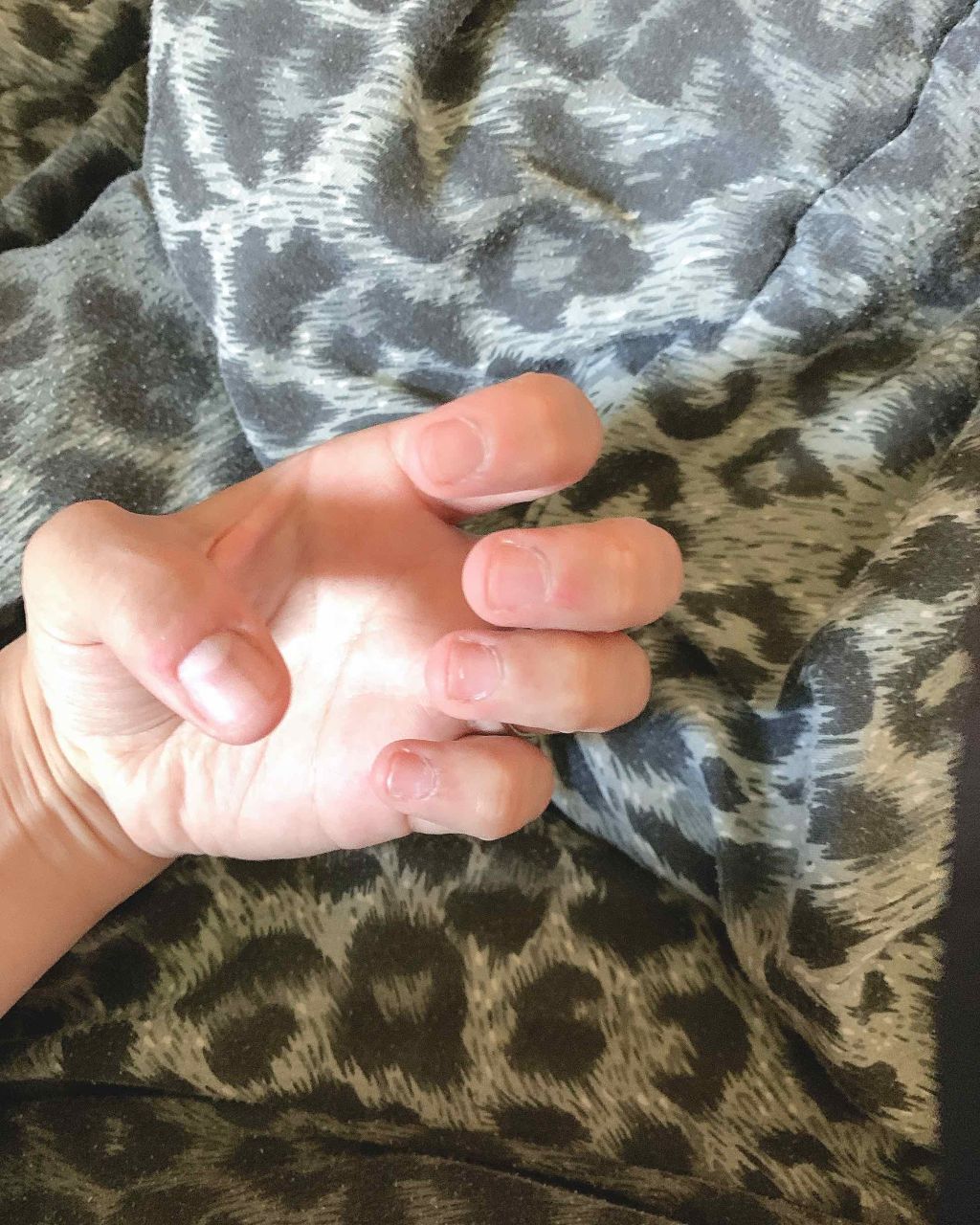 デイケアオイル/Dr.Nail/ネイルオイル・トリートメントを使ったクチコミ(2枚目)