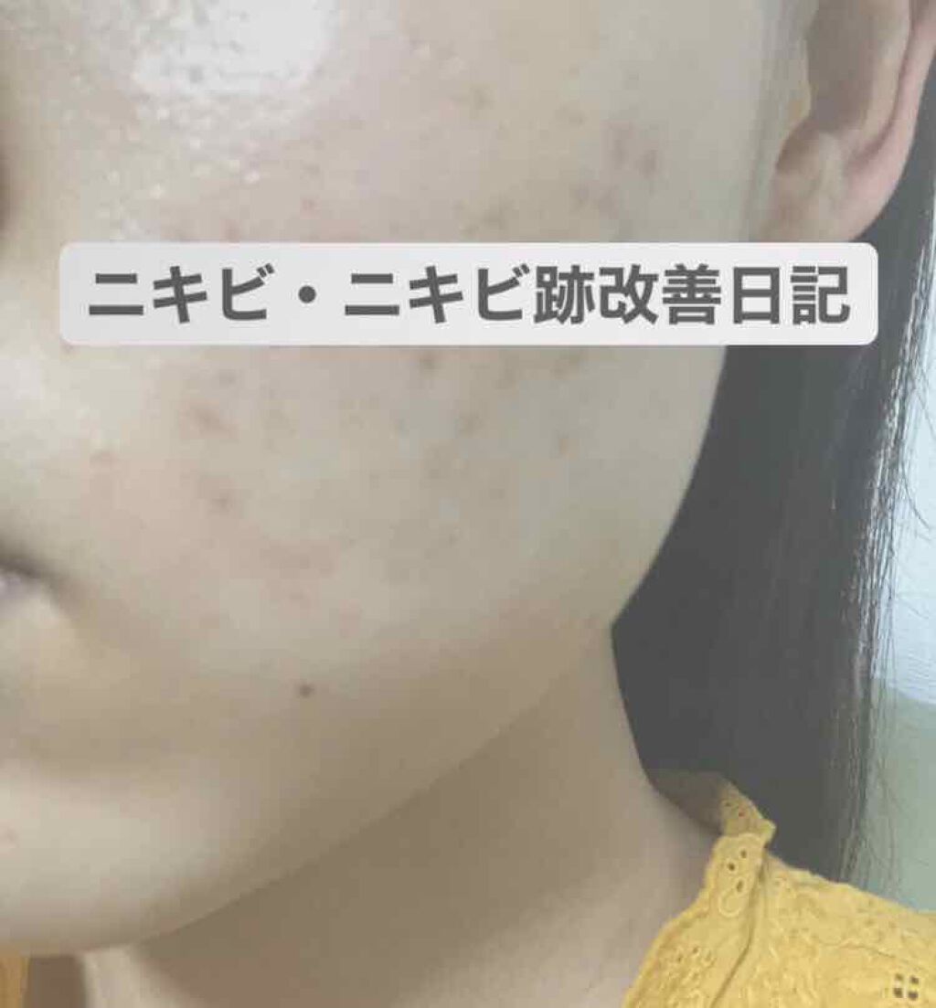 オリーブヤング ケアプラス/Olive Young/その他を使ったクチコミ（1枚目）