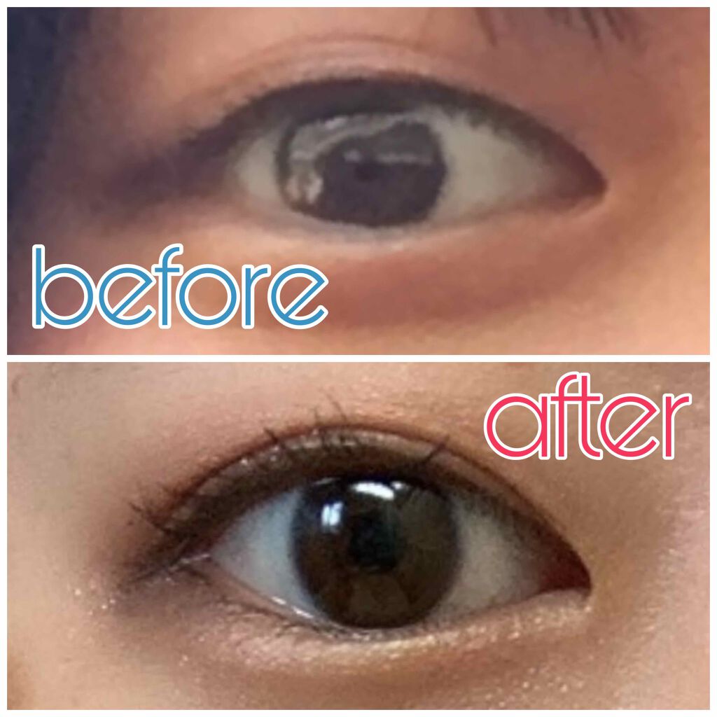 アイテープ(絆創膏タイプ、レギュラー、70枚)/DAISO/二重まぶた用アイテムを使ったクチコミ(2枚目)