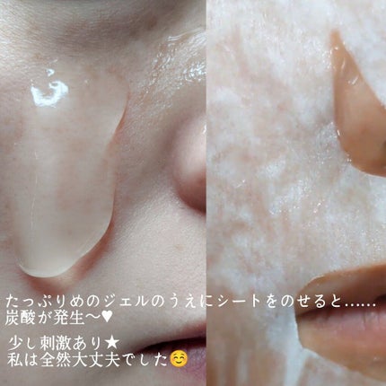 リフトブライトCO2パック/yourline/シートマスク・パックを使ったクチコミ(3枚目)