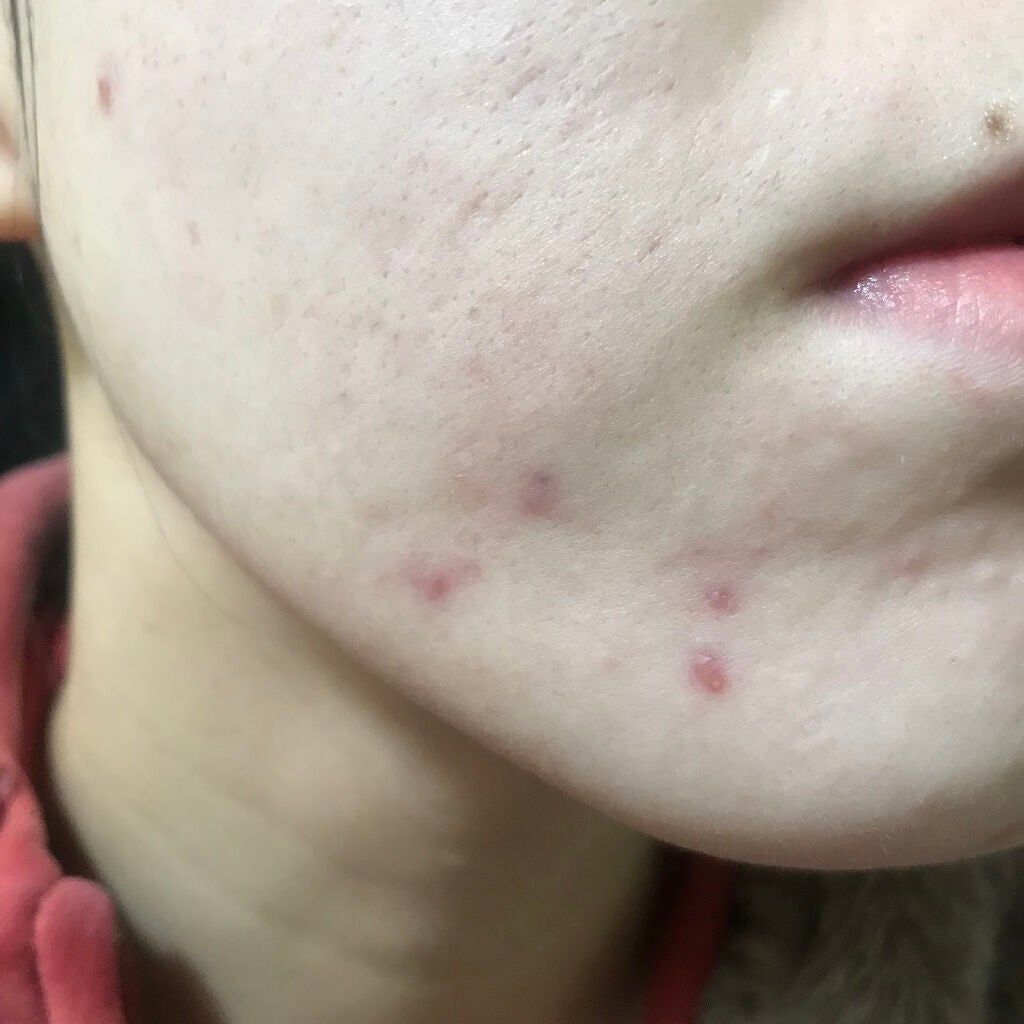 UVイデア XL プロテクショントーンアップ ローズ/ラ ロッシュ ポゼ/日焼け止めクリームを使ったクチコミ(3枚目)