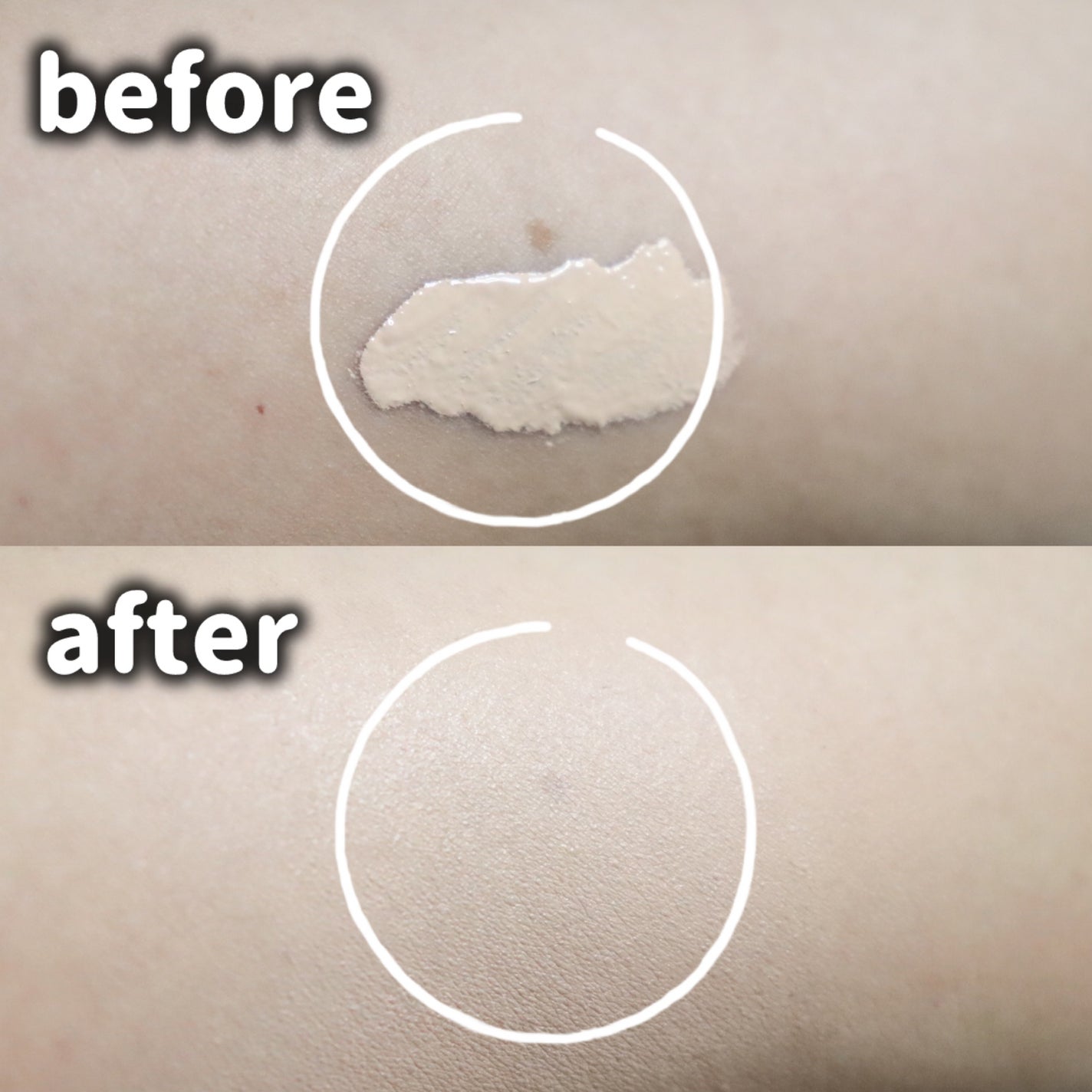 ダーマシンコンシーラー/23years old/リキッドコンシーラーを使ったクチコミ(4枚目)