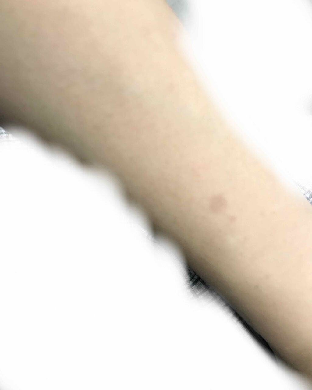 miyuki on LIPS 「アトピーではなく、自家感作性皮膚炎になったことがありその後、跡..」(1枚目)