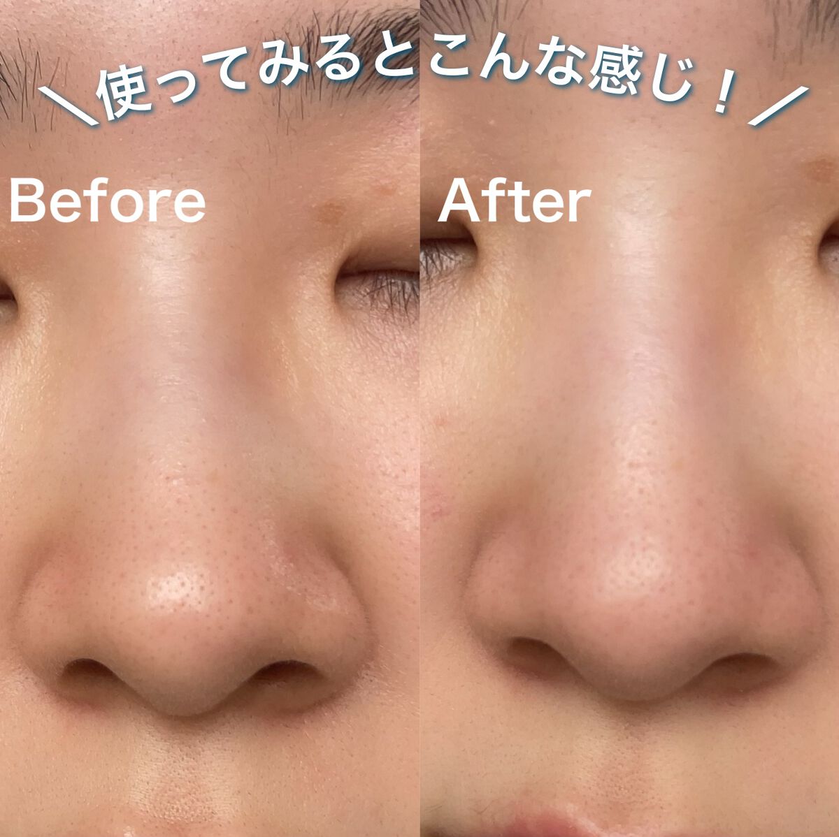 ダヴ 吸着毛穴ケア 洗顔ジェル/ダヴ/その他洗顔料を使ったクチコミ(6枚目)