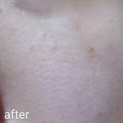 ポアカバー C/ポイントマジックPRO/化粧下地を使ったクチコミ(7枚目)