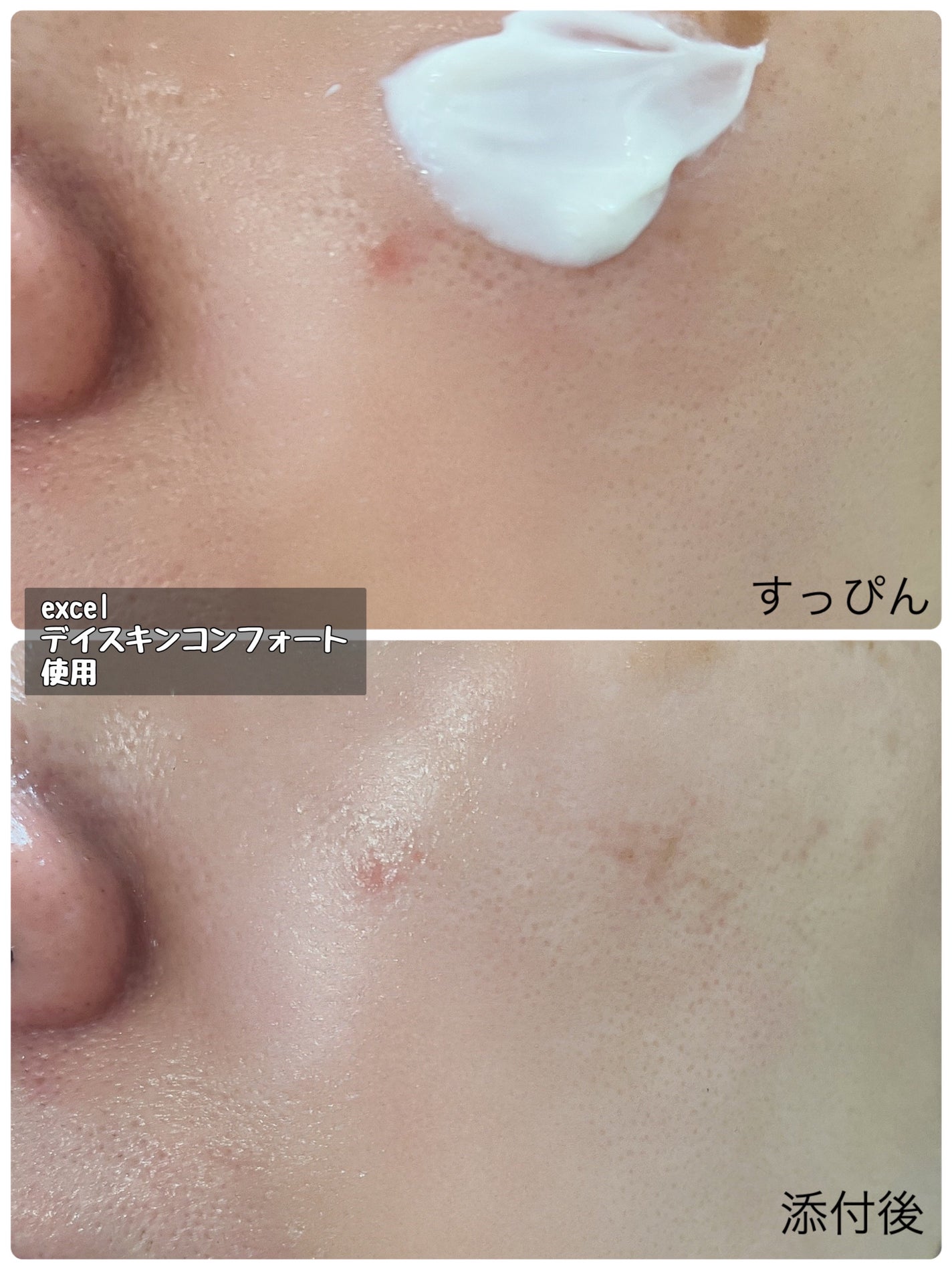 ダイブイン スキンブースター/Torriden/ブースター・導入液を使ったクチコミ(6枚目)