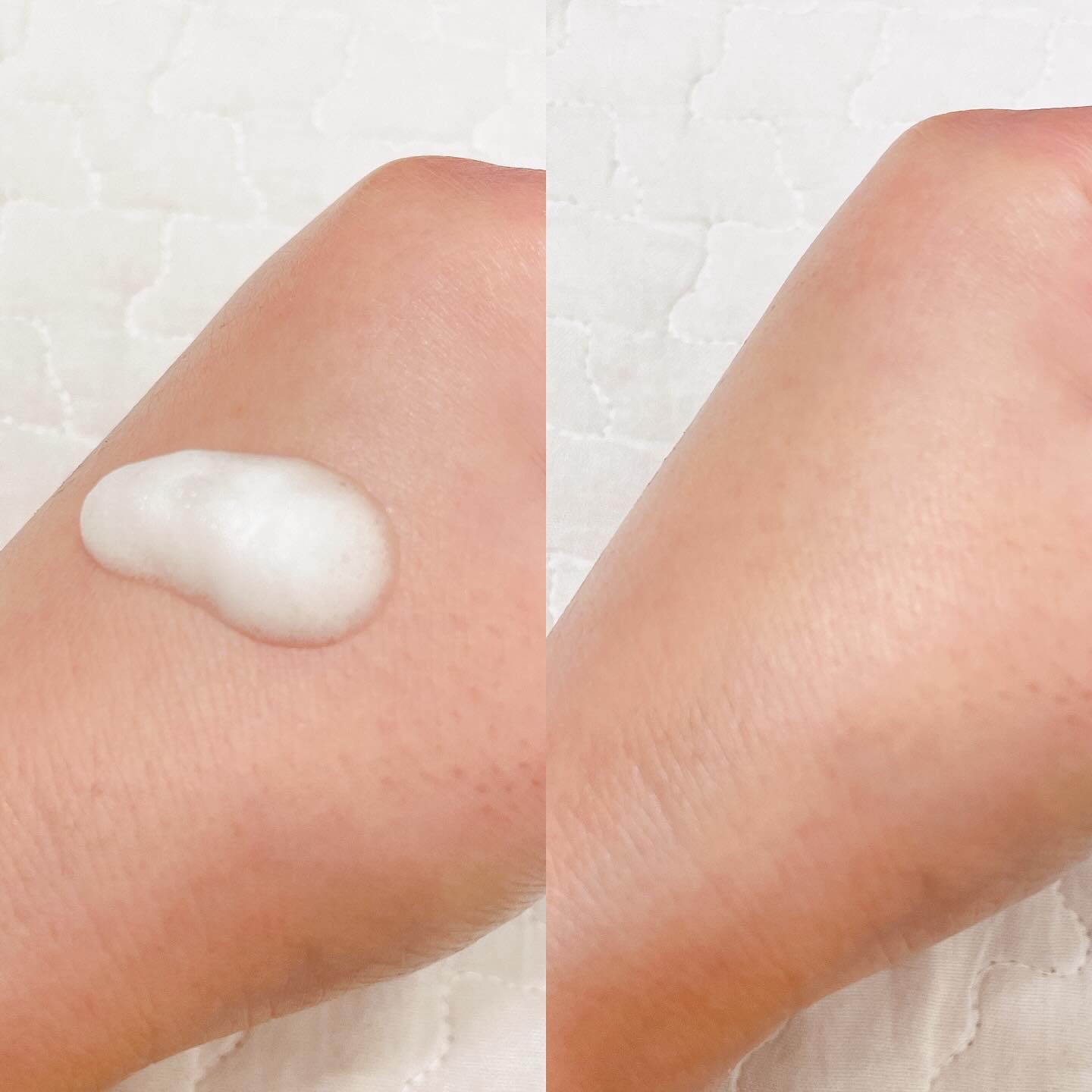 Pure VC Mellight Ampoule/Dr.Ceuracle/美容液を使ったクチコミ（2枚目）