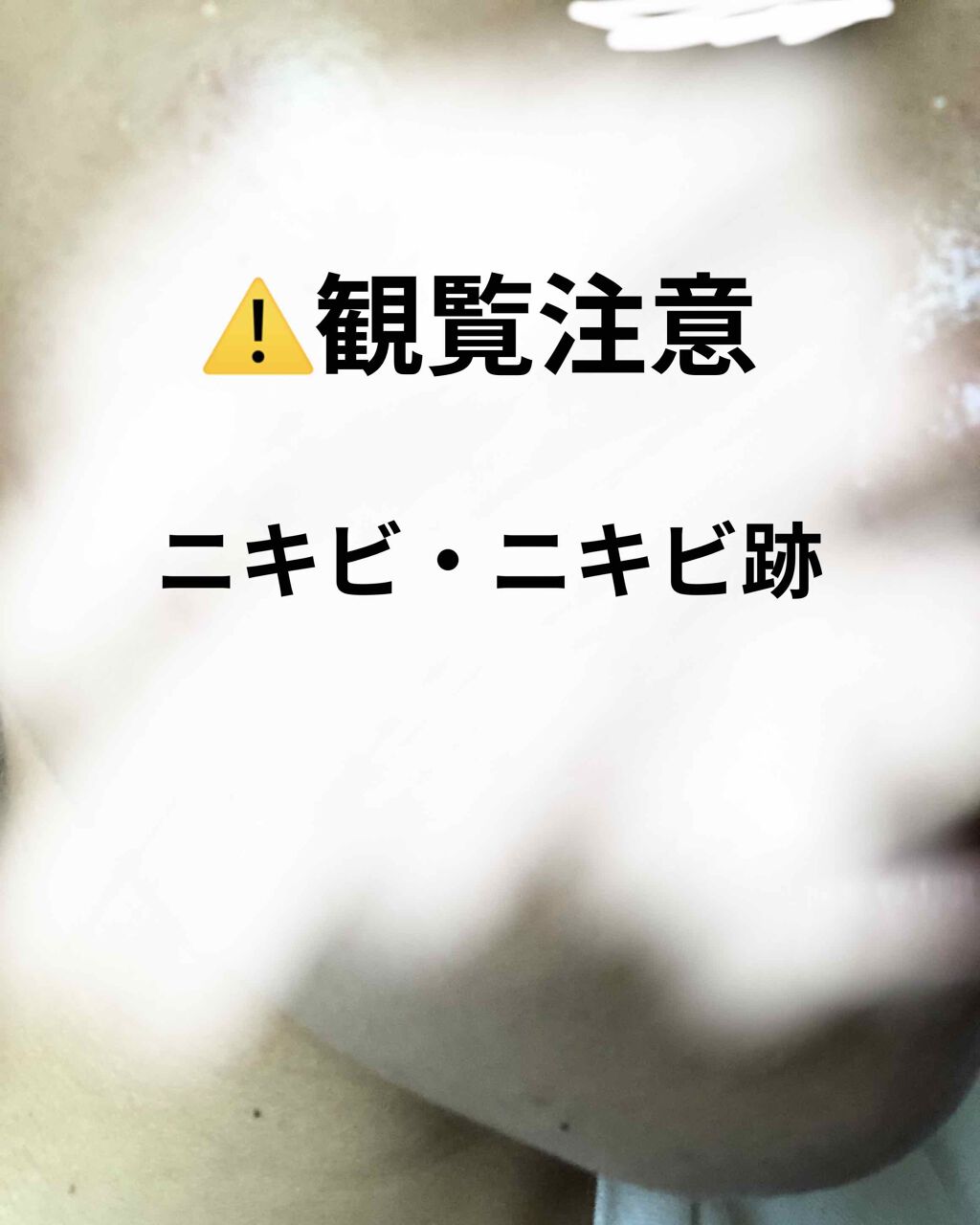 林 on LIPS 「初めまして!初投稿です…画像を見て不快になられた方もいると思い..」(1枚目)