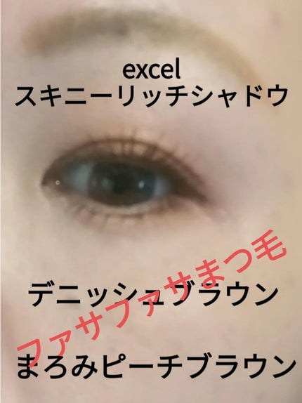 ビヨンセ奥二重向上委員長🥸LIPSパートナー🥳 on LIPS 「私はこれしか使わない。だってコスパ最強だし私の場合は2週間で実..」(2枚目)