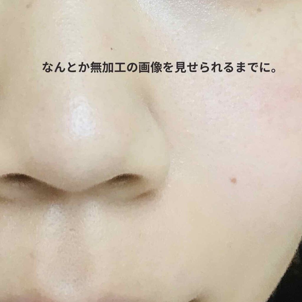 薬用プロテクトウォッシュ/アクネバリア/洗顔フォームを使ったクチコミ（2枚目）