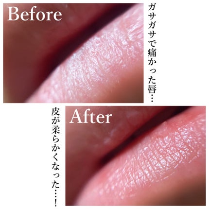 薬用リップスティックXD/メンソレータム/リップクリームを使ったクチコミ(3枚目)