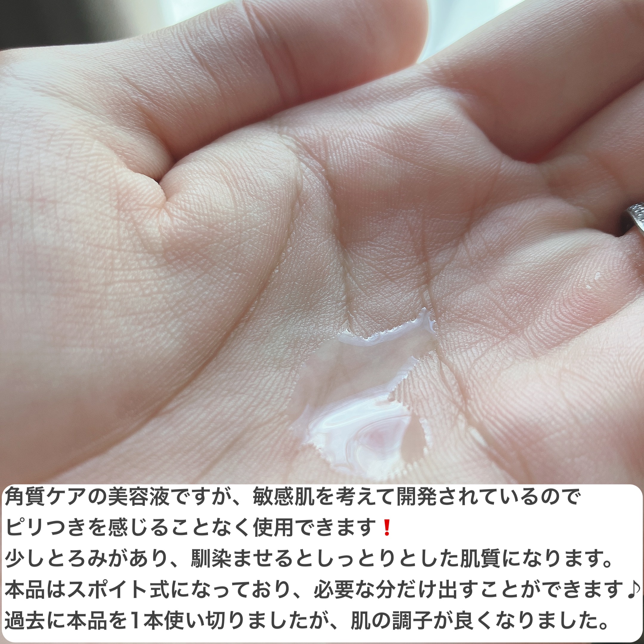 エファクラ ピールケア セラム/ラ ロッシュ ポゼ/美容液を使ったクチコミ（3枚目）