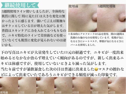 アロフローラ アクネケア クレンジングジェル/ハウス オブ ローゼ/クレンジングジェルを使ったクチコミ(4枚目)