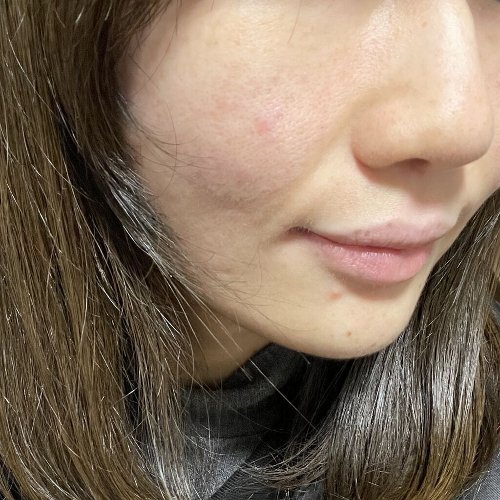 ビフィズス菌化粧水/ONE THING/化粧水を使ったクチコミ（2枚目）