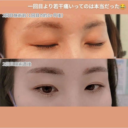 ᎮꭿꮪꮪꭵFꮮꭴꮢꭿ on LIPS 「先週の月曜日に眉毛アートメイク2回セットの2回目に行ってきたよ..」(4枚目)