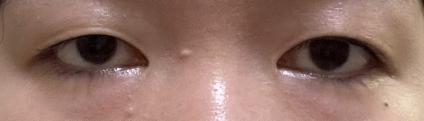 メッシュ アイテープ/shefun/二重まぶた用アイテムを使ったクチコミ(2枚目)