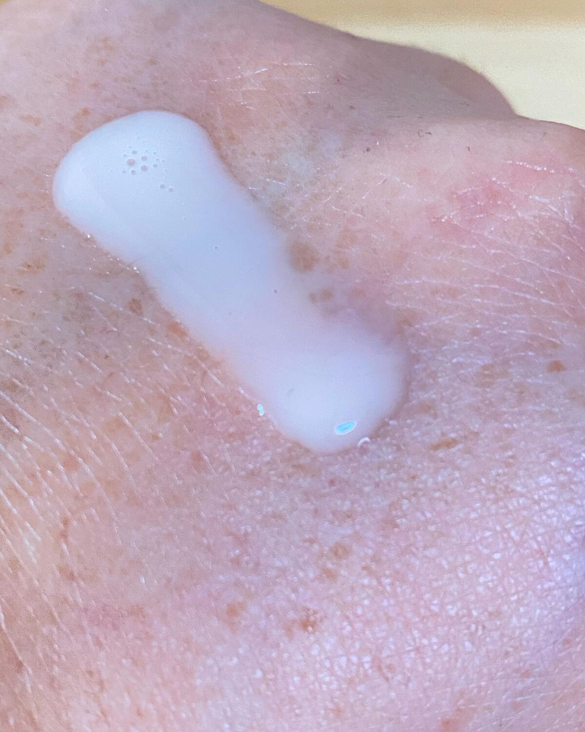 VC100エッセンスローション EX/ドクターシーラボⓇ/化粧水を使ったクチコミ(7枚目)