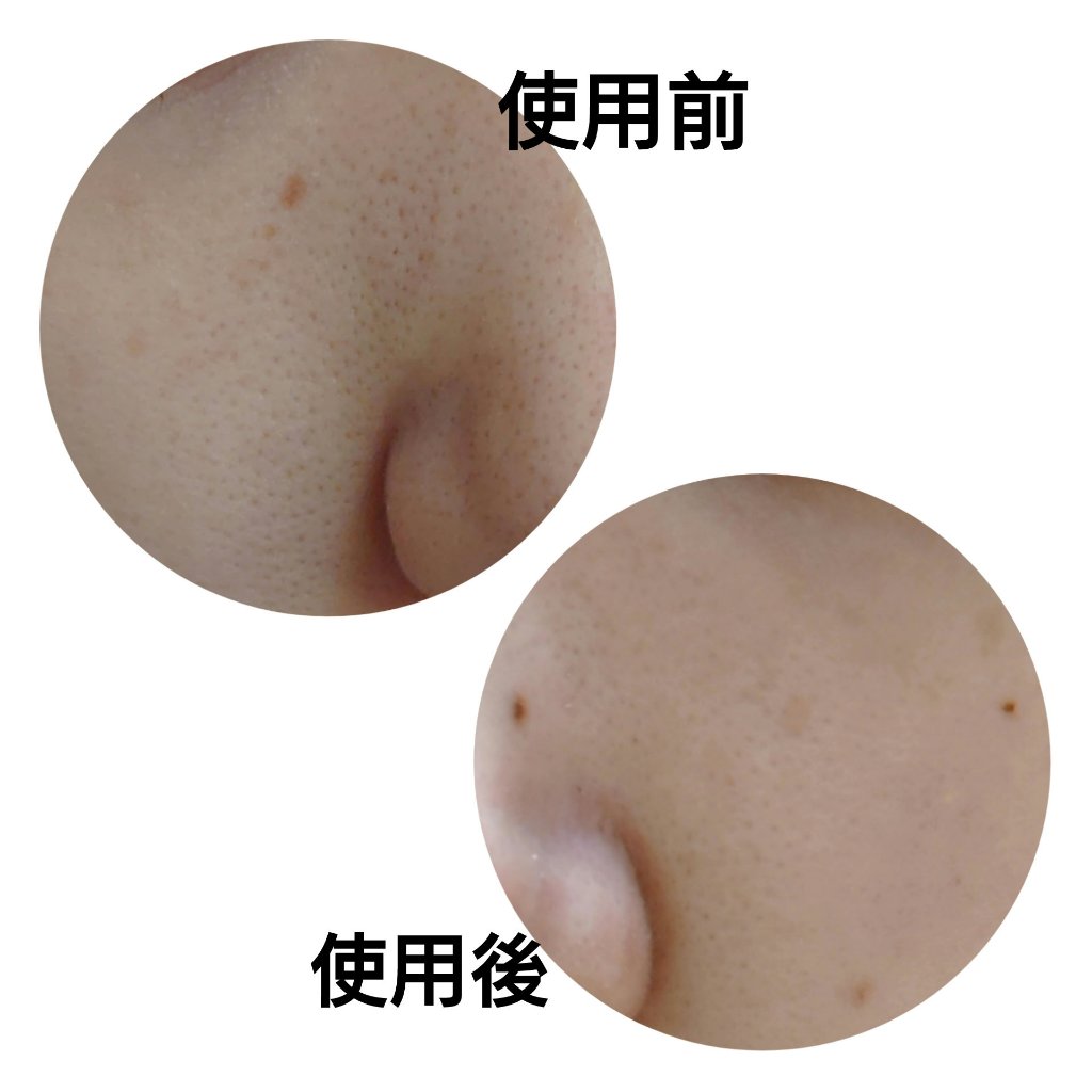 タカミスキンピール/タカミ/ブースター・導入液を使ったクチコミ（2枚目）