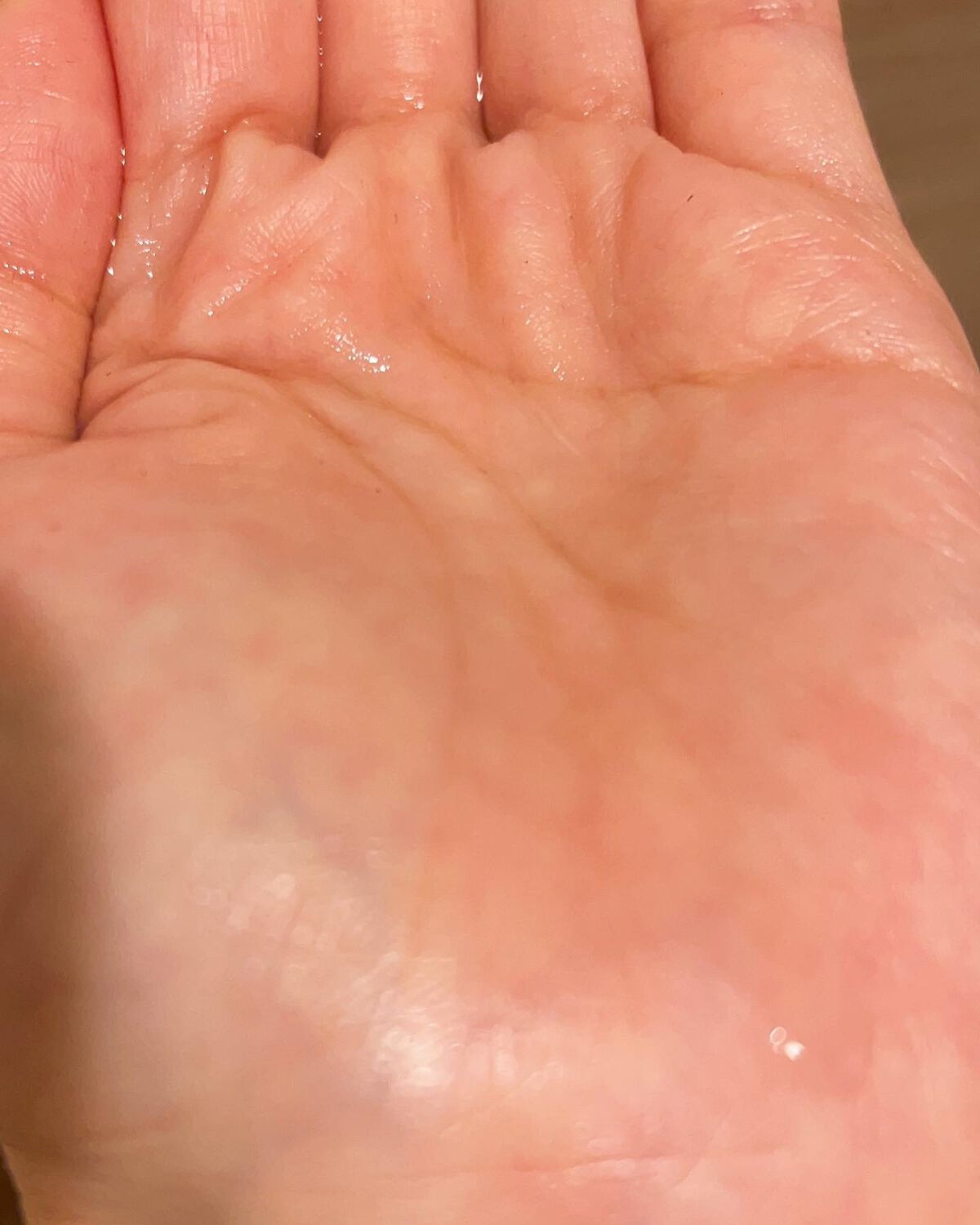 イドラクラリティ 薬用 トリートメント エッセンス ウォーター/DECORTÉ/化粧水を使ったクチコミ(4枚目)